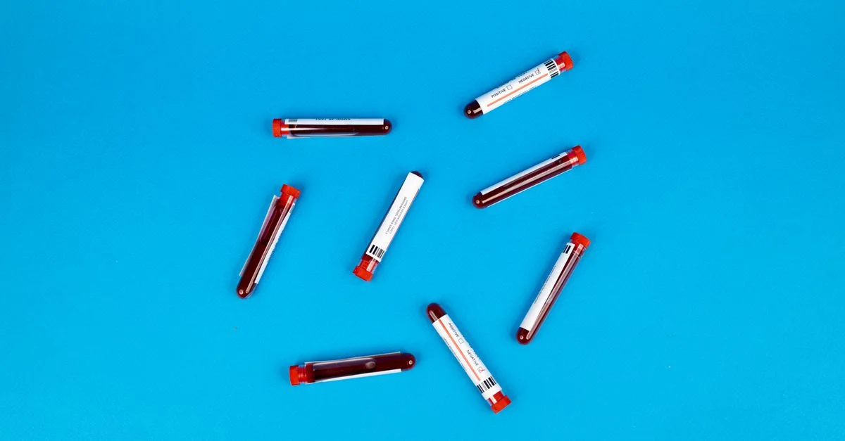 Múltiples tubos de muestras de sangre dispuestos sobre un fondo azul vívido.